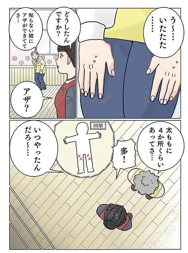 知らないアザ （C）でこぽん吾郎／KADOKAWA
