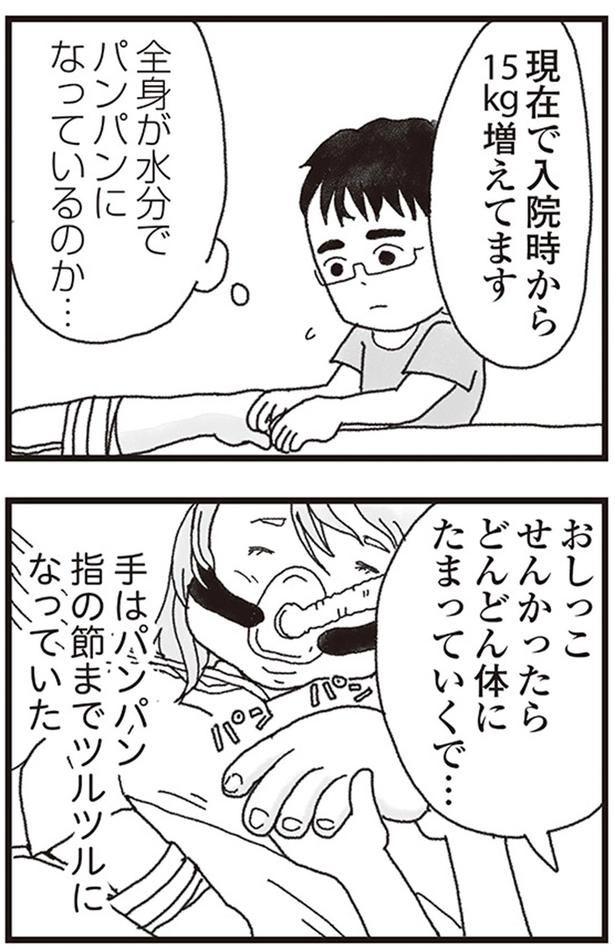 全身が水分でパンパンになっているのか