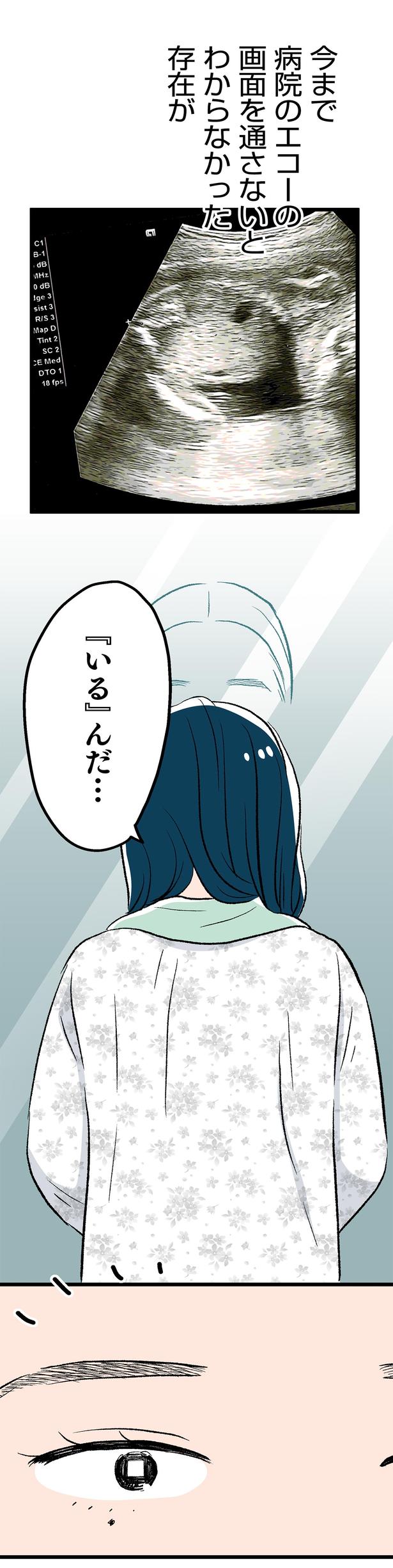 病院のエコーの画面を通さないとわからなかった存在が