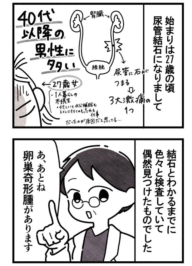 27歳で尿管結石になった女性『卵巣嚢腫手術レポ』03 画像提供:まえだ永吉さん