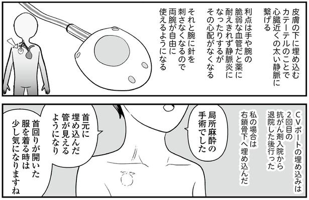 CVポートとは （C）くぐり／KADOKAWA