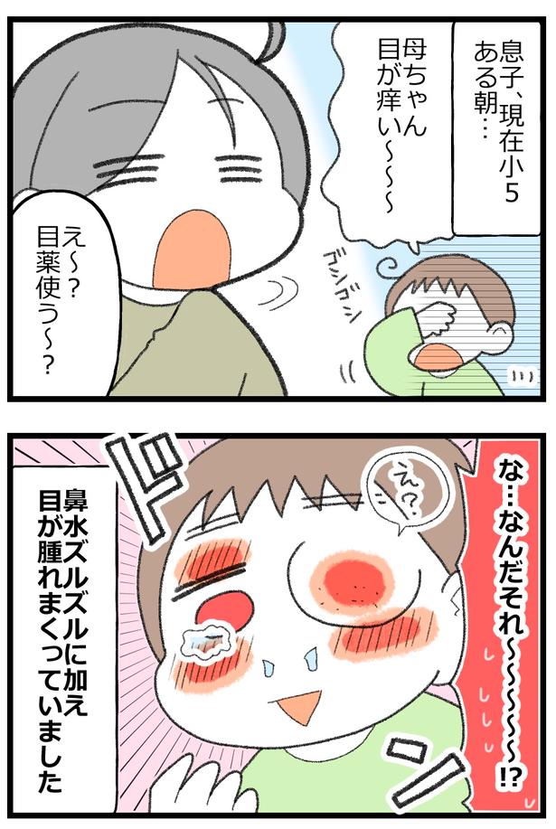 息子がアレルギーで舌下免疫療法をはじめた話2 画像提供:エェコ(@nakiri_aik)