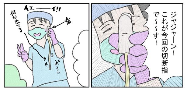 指(5)