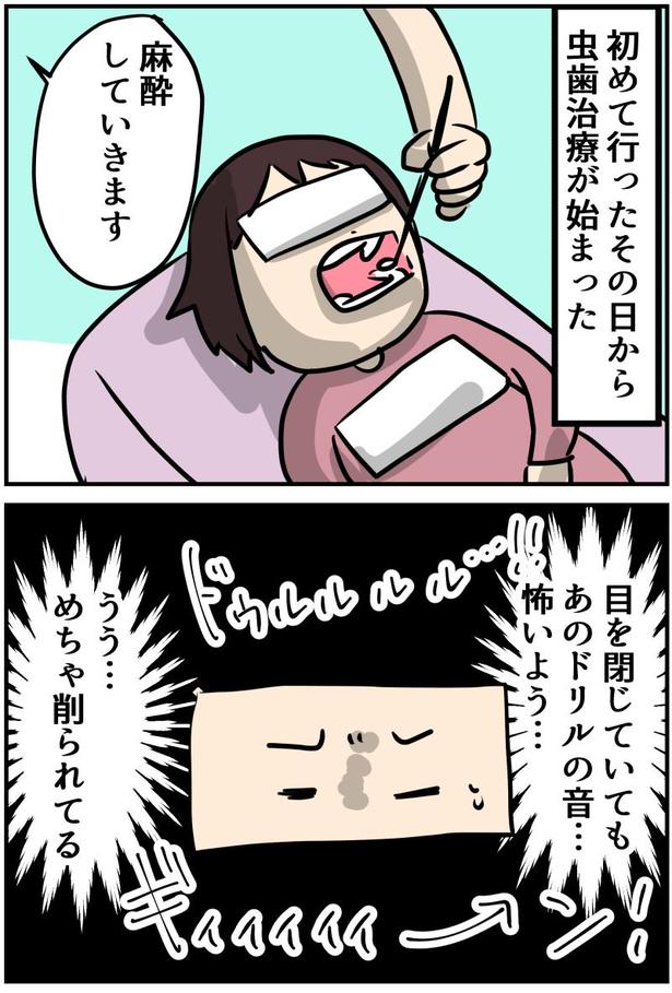 5-1