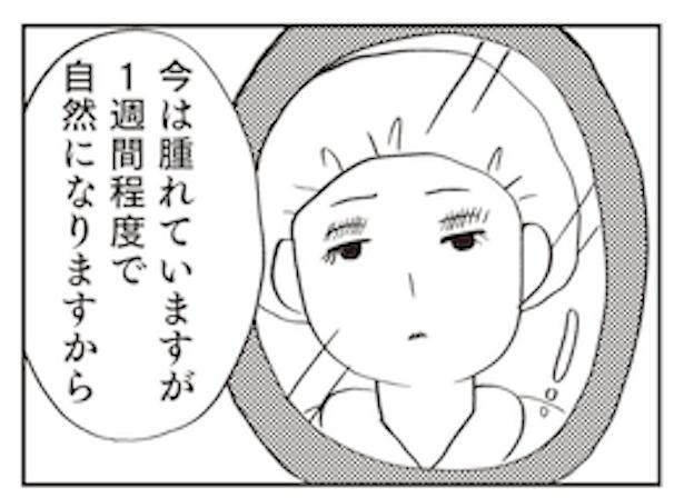 「親に整形させられた私が母になる　エリカの場合」2 画像提供：(C)グラハム子
