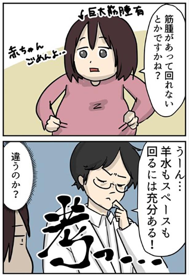 「逆子の原因」1-2 画像提供：しゃけなかほいさん