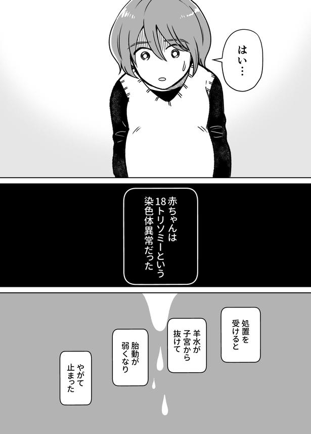 「わたしが選んだ死産の話」1話_002 画像提供：(C)桜木きぬ(@kinumanga)／KADOKAWA