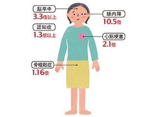 閉経後の女性の70％以上が血圧が高め!? 高血圧のリスクと改善に大切な「NO」と「カリウム」とは？（1）