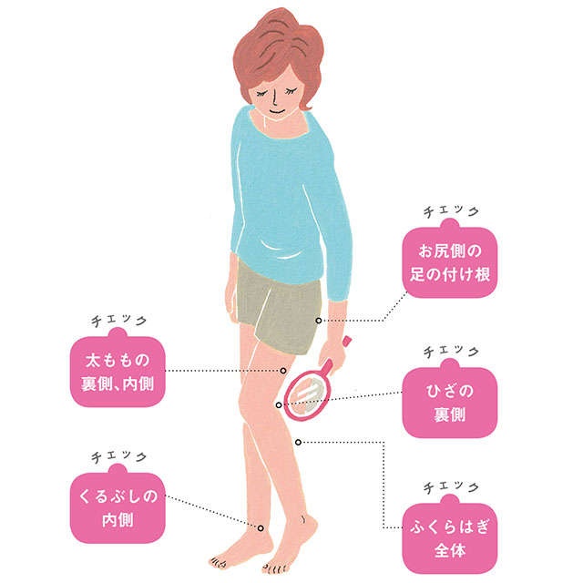 「下肢静脈瘤」をセルフチェック！ 血管が浮き出てる？ 赤く透けてる？ 治療の流れも詳しく解説（2）