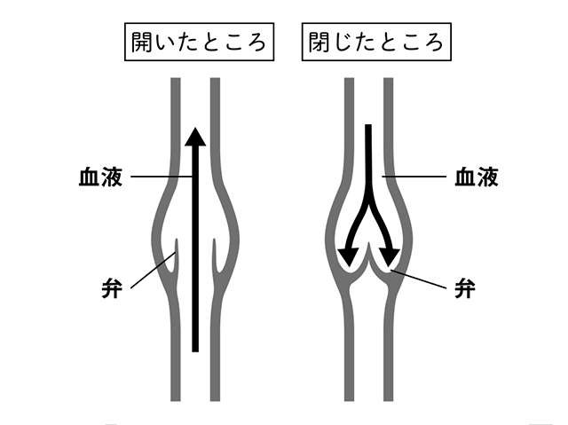 「下肢静脈瘤」はなぜ起こる？ 身体の仕組みを理解して「リスク」に備えよう（4）