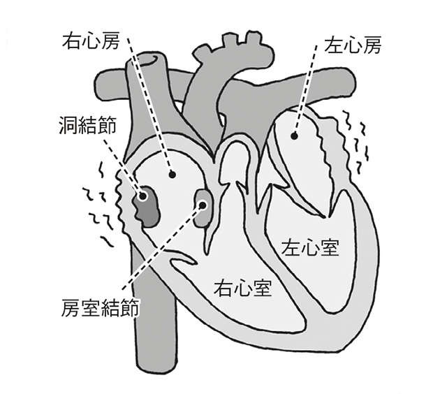 心筋梗塞や心不全の前兆となることも！ 命に関わる危険な「不整脈」の見分け方（3）