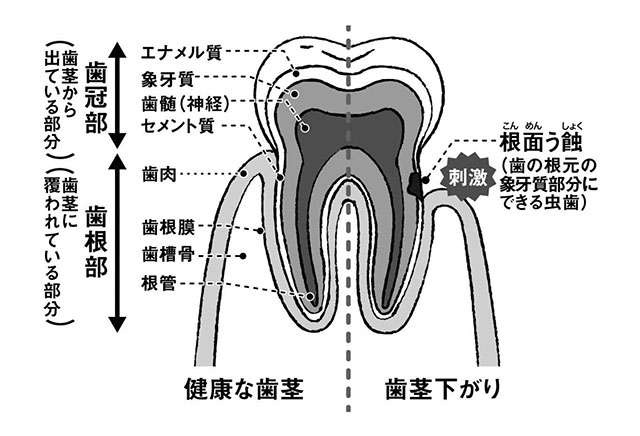 知覚過敏や虫歯で困らないための『歯肉を下げない習慣』。予防には正しいブラッシングを！（2）