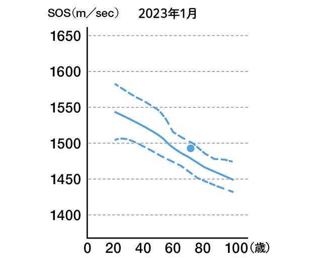 脳の活性化や肌の老化を防ぐ役割も！ 意外と知らないすごい「骨」の力と鍛え方を医師が解説（12）