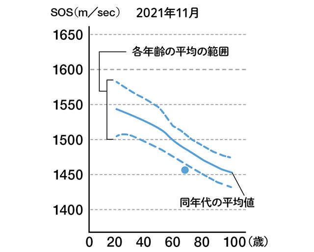 脳の活性化や肌の老化を防ぐ役割も！ 意外と知らないすごい「骨」の力と鍛え方を医師が解説（13）