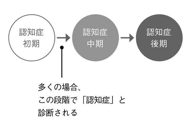 専門医が指南する！認知症予備軍の「軽度認知障害」をセルフチェック（4）