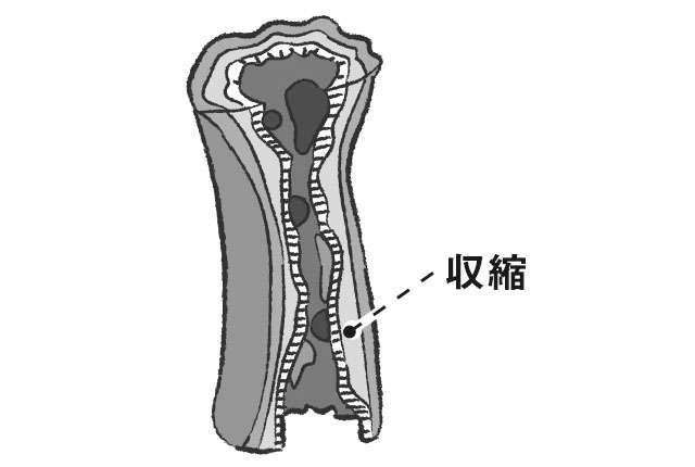 「喘息」について専門医・松瀬厚人先生が解説！ 高齢女性は重症化しやすいので注意を（6）