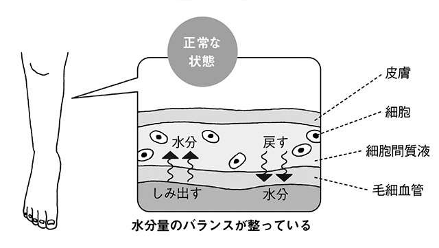 心臓血管外科医の藤井先生が指南！「危険なむくみ」は原因を知って早めに治療を（3）
