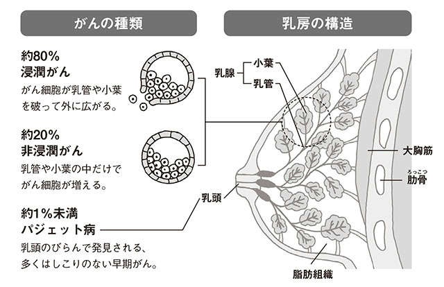 専門医の大野真司先生が警鐘「乳がんはゼロ期なら5年生存率はほぼ100％、だから乳がん検診を」（4）