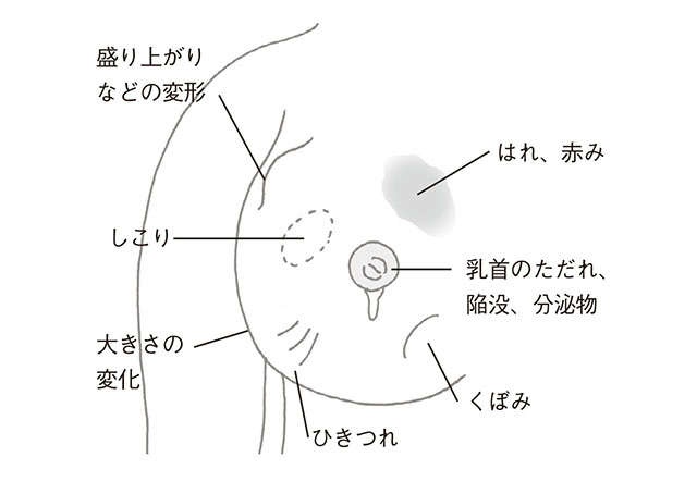 専門医の大野真司先生が指南「乳がん早期発見のために、月1回は自己触診を！」（7）