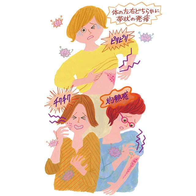 皮膚科医・本田先生に聞きました。50歳以上で急増！ 帯状疱疹対策はワクチン接種が有効（2）