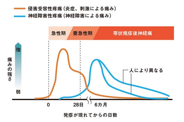 水ぼうそうのウイルスが数十年後に暴れだす？ 専門医の本田まりこ先生に「帯状疱疹」について聞きました（5）