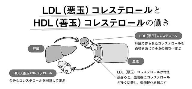 閉経後は要注意！脳梗塞などのリスクも高くなる「脂質異常症」セルフチェック【医師・栗原先生が指南】（4）
