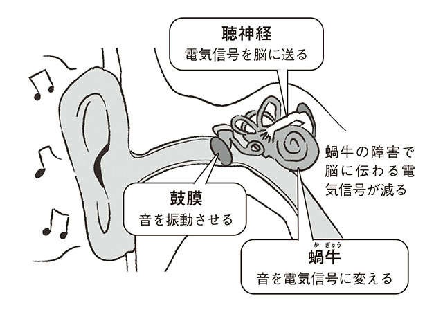 「耳鳴り」が気になったら。解決に必要な、正しい知識と補聴器治療【聴覚医学の専門家・新田先生が解説】（3）