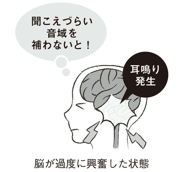 「耳鳴り」が気になったら。解決に必要な、正しい知識と補聴器治療【聴覚医学の専門家・新田先生が解説】（7）