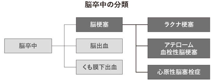 死亡率最悪の脳塞栓症、睡眠中に起こる危険な脳梗塞...3種類の「脳梗塞」に注意しよう（3）
