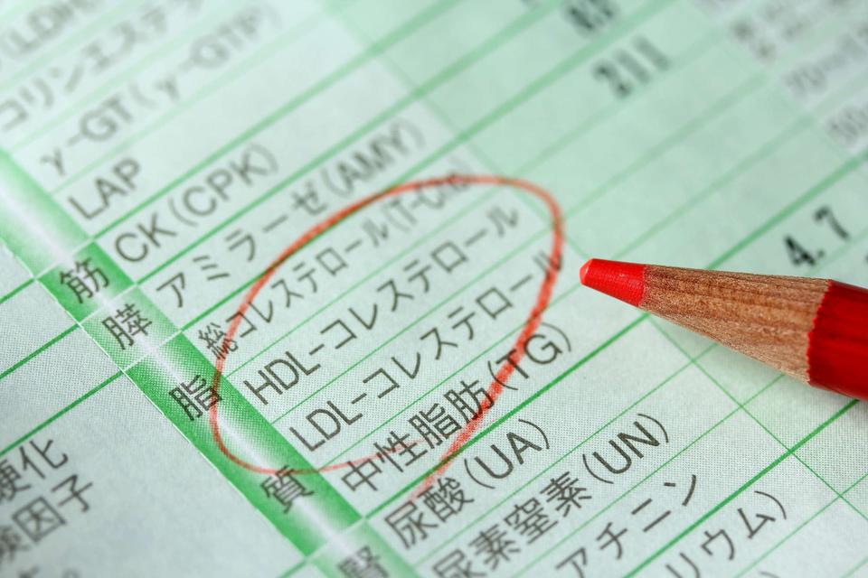 コレステロール値は、高めのほうが健康的!? 「敵視」すべきコレステロールの「正体」（1）