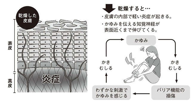 冬に気になる「肌のかゆみ」。保湿剤の効果的な使い方など、予防法や原因を皮膚科医の戸倉新樹先生が解説（3）