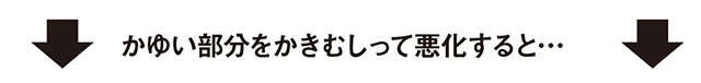 冬に気になる「肌のかゆみ」。保湿剤の効果的な使い方など、予防法や原因を皮膚科医の戸倉新樹先生が解説（5）