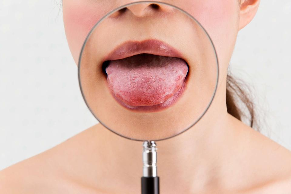 舌を見れば、カラダの不調がわかる！ 「正常な舌の特徴」5つ【チェックリストあり】（1）