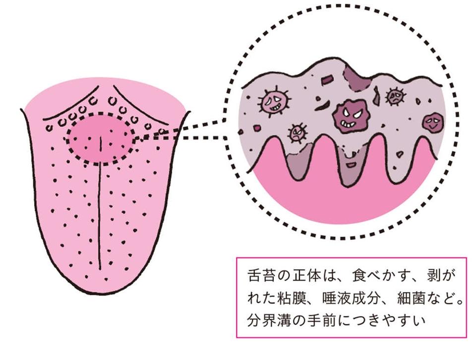 舌を見れば、カラダの不調がわかる！ 「正常な舌の特徴」5つ【チェックリストあり】（画像7/9枚目）