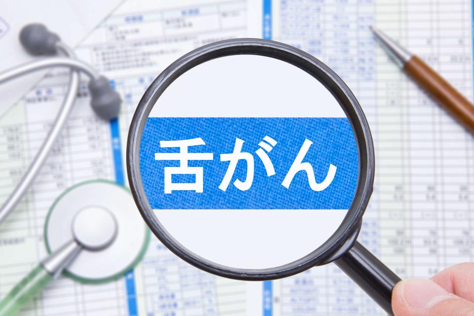 1週間治っていない口内炎がある？ 「舌がん」を予防する5つのチェックリスト【チェックリストあり】（1）