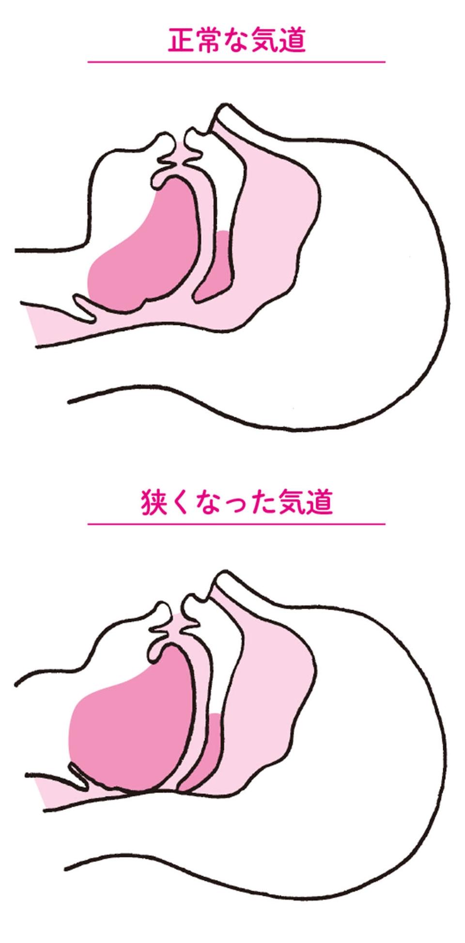 女性の「いびき」のきっかけは閉経が多。女性ホルモンと「舌力」、いびきの関係【チェックリストあり】（4）