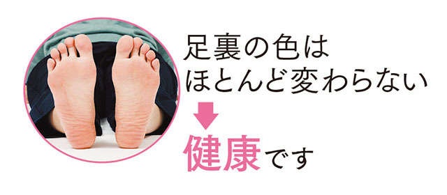 肌年齢や動脈硬化の改善に！ 「足の健康チェック法」と「足の血管力」アップ体操【医師・池谷敏郎先生が指南】（6）