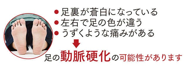 肌年齢や動脈硬化の改善に！ 「足の健康チェック法」と「足の血管力」アップ体操【医師・池谷敏郎先生が指南】（7）