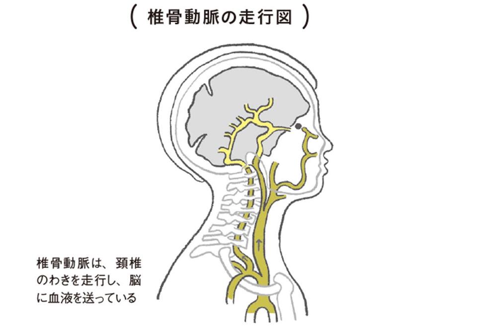 首の骨を鳴らす「首ポキ」が危険な理由。厚生労働省が警鐘を鳴らす「椎骨動脈解離」の発生リスク（3）