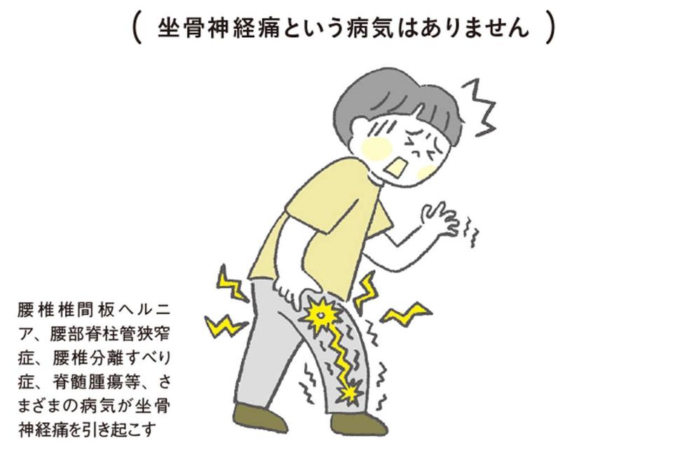 「坐骨神経痛」という病気はない!? 坐骨神経痛の名前に隠された、代表的な「4つの疾患」（3）