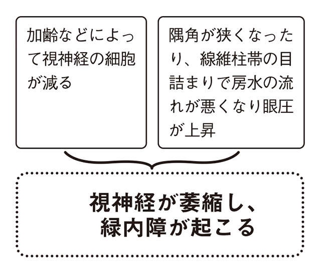 加齢に伴い発症しやすくなる「緑内障」。原因や治療法を眼科医の谷戸正樹先生が解説（4）