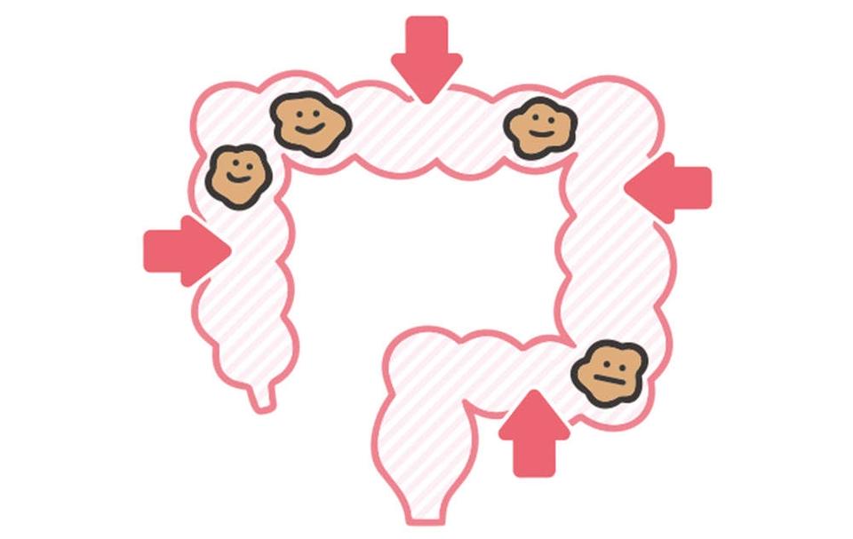 出したのにお腹が張るのは、おしりの「出口」で事件が発生!? 「出口の便秘」とは【チェックシート付】（4）