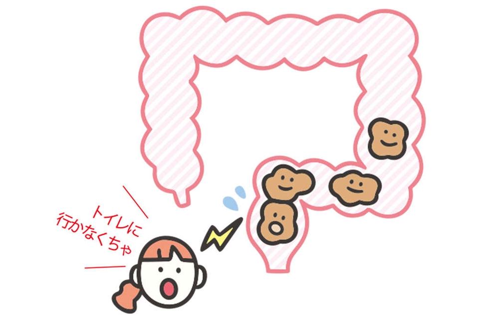 出したのにお腹が張るのは、おしりの「出口」で事件が発生!? 「出口の便秘」とは【チェックシート付】（7）