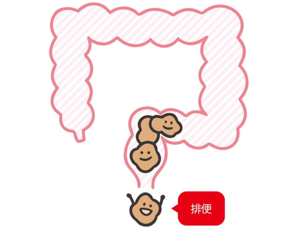 出したのにお腹が張るのは、おしりの「出口」で事件が発生!? 「出口の便秘」とは【チェックシート付】（9）