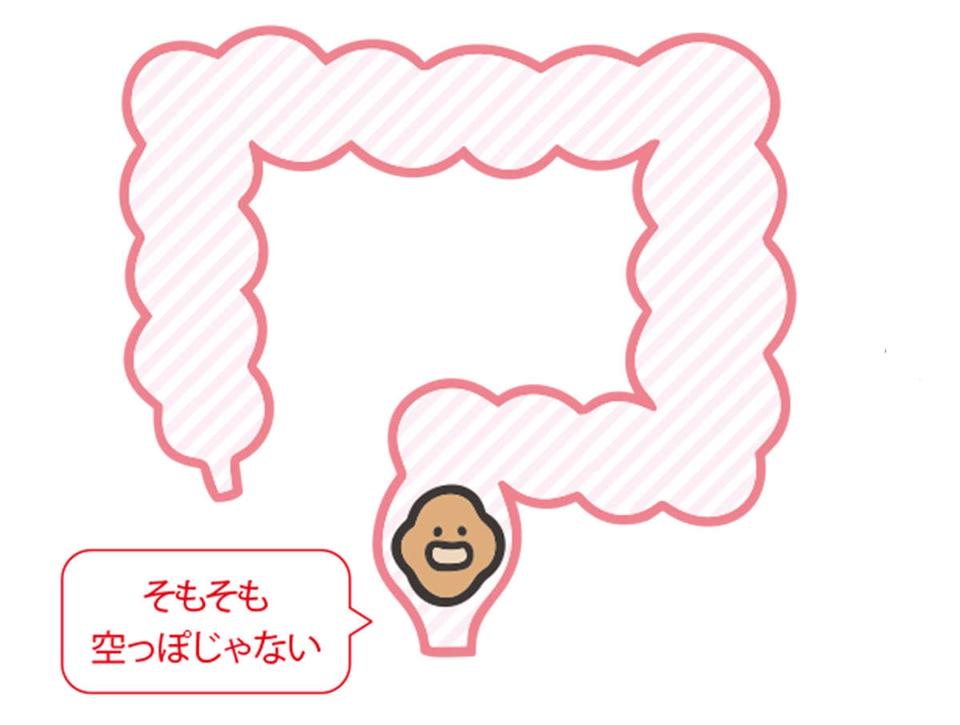 出したのにお腹が張るのは、おしりの「出口」で事件が発生!? 「出口の便秘」とは【チェックシート付】（10）