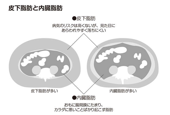 体に付く脂肪は1種類じゃない!? 「内臓脂肪」が「皮下脂肪」より厄介な理由（3）