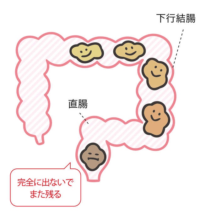 毎日便が出るからと言って「全部出ている」わけじゃない？ 勘違いしがちな「便秘」の定義（3）