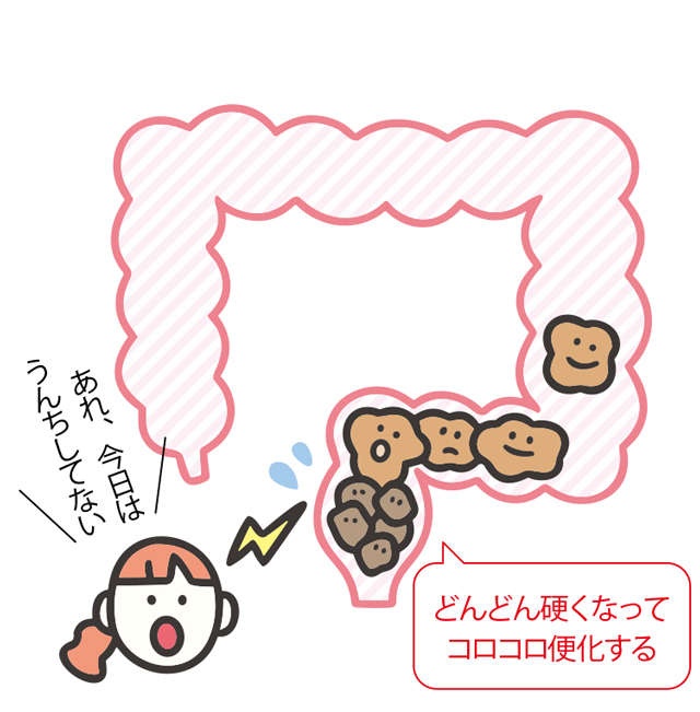 毎日便が出るからと言って「全部出ている」わけじゃない？ 勘違いしがちな「便秘」の定義（4）