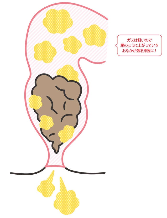 おなかがゆるい、下痢をくり返す。実はこれも「便秘」!? 汗や口のニオイにも関係する「出口の便秘」（5）