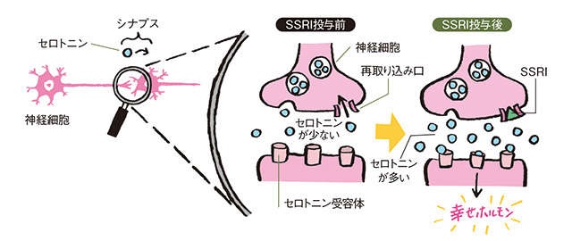 高齢者の「うつ病」に有効な治療法を、神科医の和田秀樹先生が解説（3）